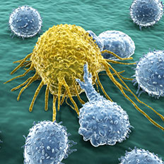 Krebszelle und Lymphozyten.