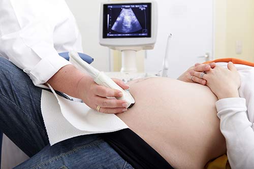 Eine Ärztin macht einen Ultraschall bei einer schwangeren Frau.