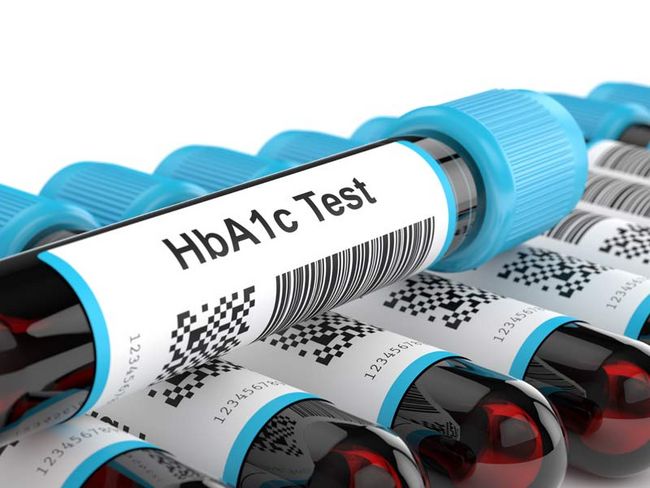 Mehrere Laborröhrchen liegen übereinander mit der Auffschrift "HbA1c Test".