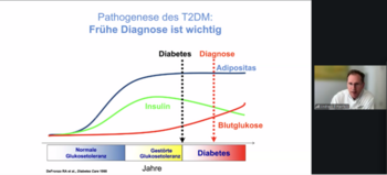 Screenshot aus dem Vortrag von Prof. Dr. Andreas Birkenfeld zur Remission des Typ-2-Diabetes.