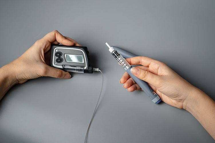 Eine Insulinpumpe und ein Pen