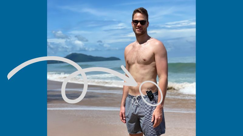 Fabian Bleck am Strand in Badeshorts, an der seine Insulinpumpe befestigt ist
