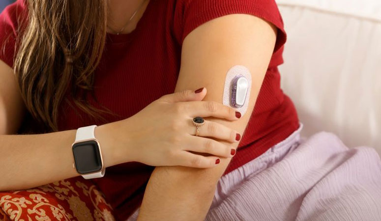 Der Arm einer Frau mit einem Glukosesensor und einer Smartwatch