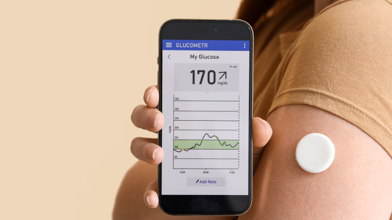 Eine Person mit einem Blutzuckersensor am Arm zeigt auf dem Smartphone ihren Blutzuckerverlauf